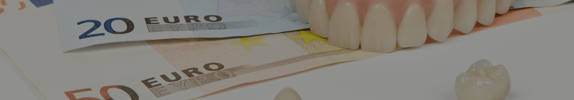 Dental Implants Cost From $2000 Up To $100,000