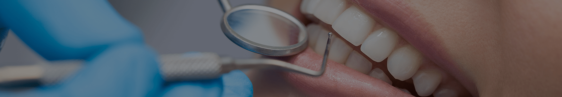 What Is The Cost Of Single Tooth & Full Mouth Dental Implants (USA)?